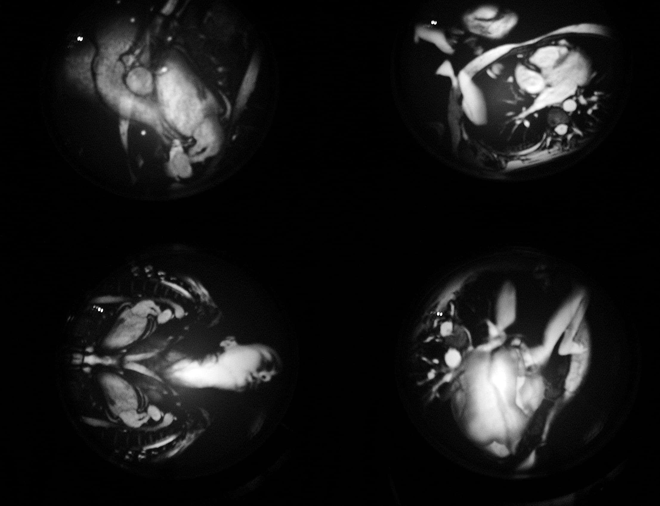 99種關於愛情的基因圖譜—戀人的眼球