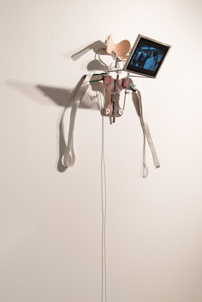 重複使力傷害症候群