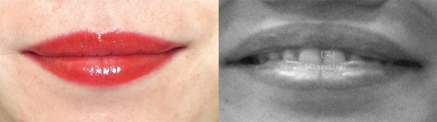 ourlip-frame-01_1_orig