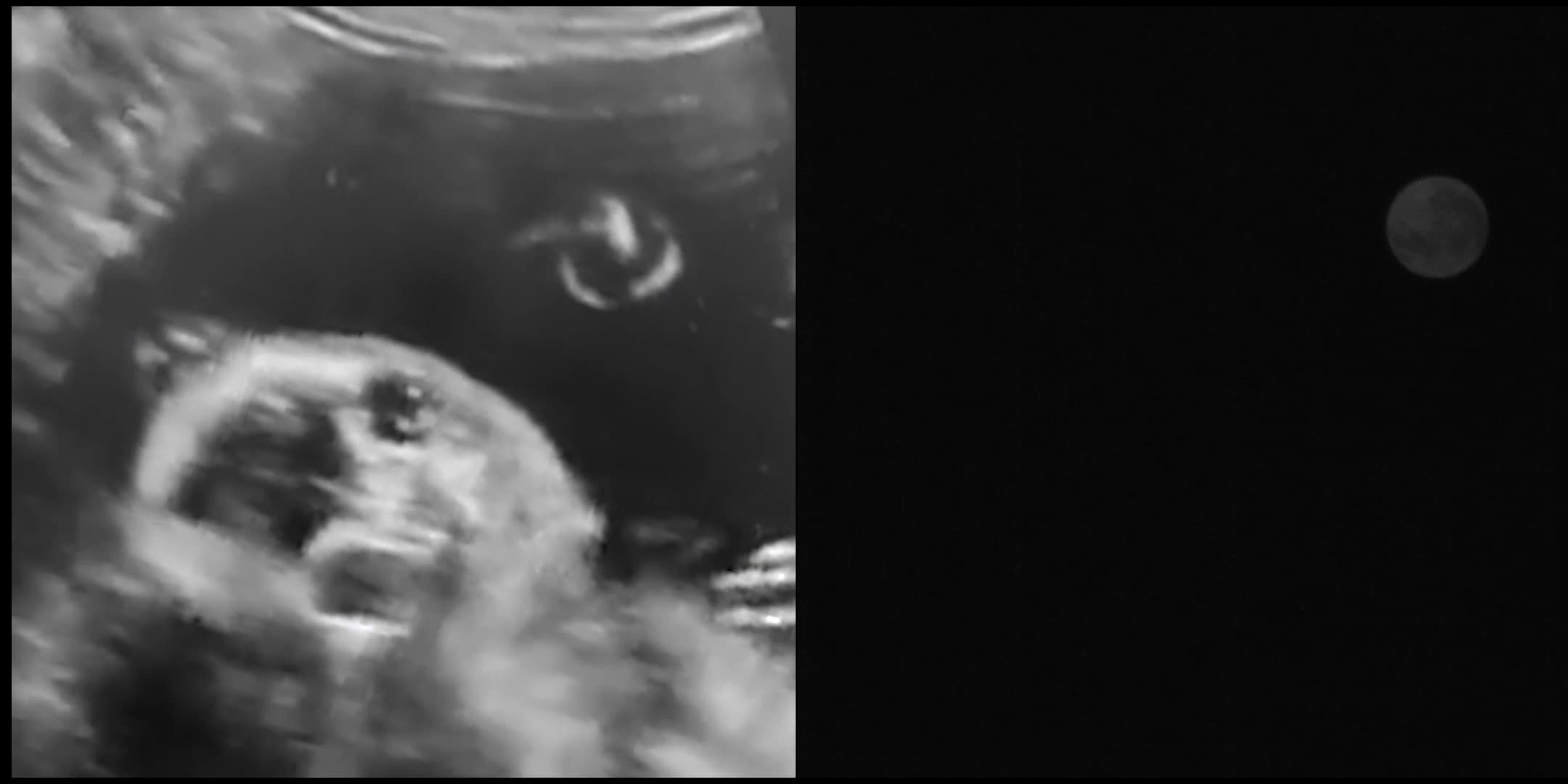 The Embryo's Dream, Upon the Moon